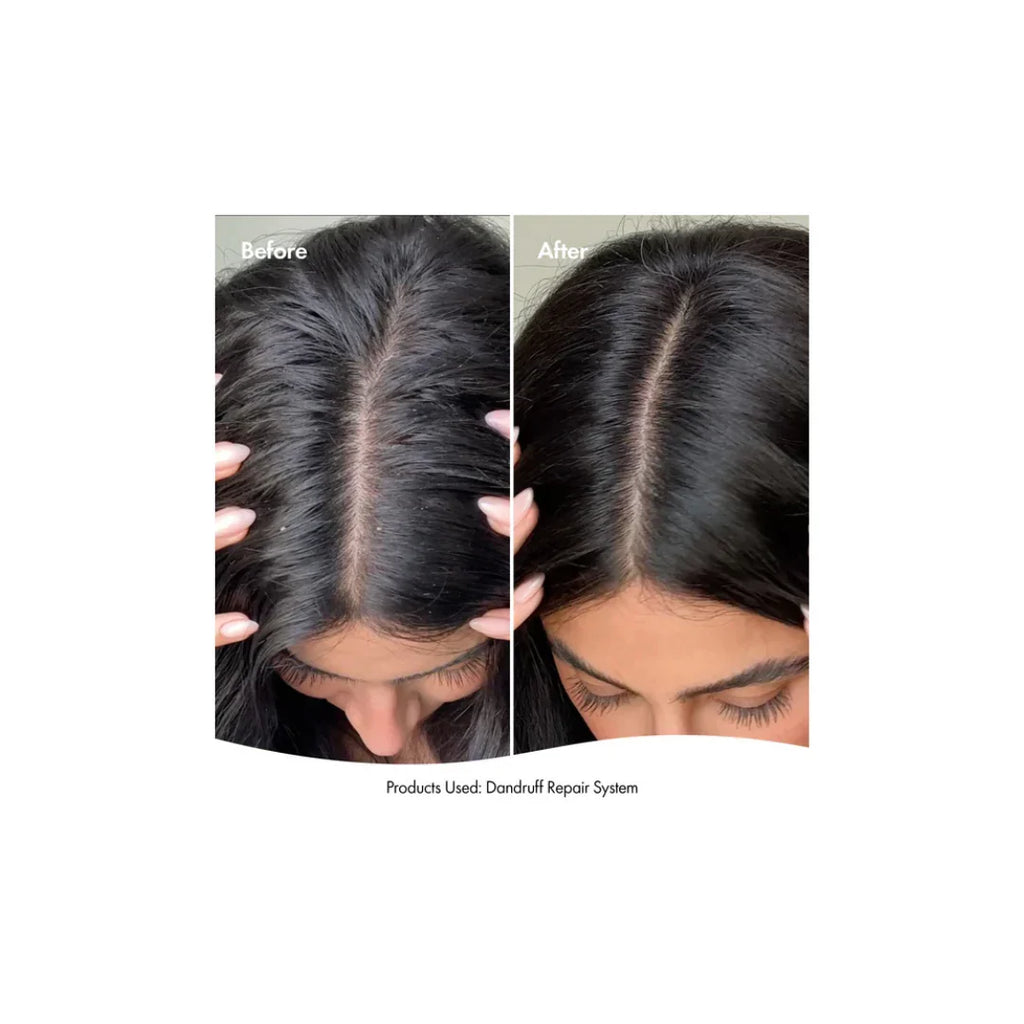 BondiBoost BONDI BOOST DANDRUFF REPAIR HAIR MASK 250ML - image 3
